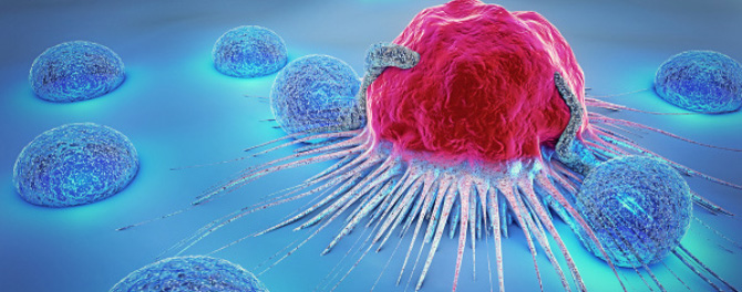 an image of a tumour